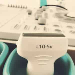 Doppler- und Duplexsonographie der Arterien