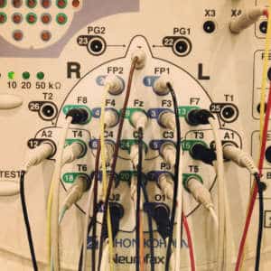 EEG – Messung der elektrischen Gehirnaktivität